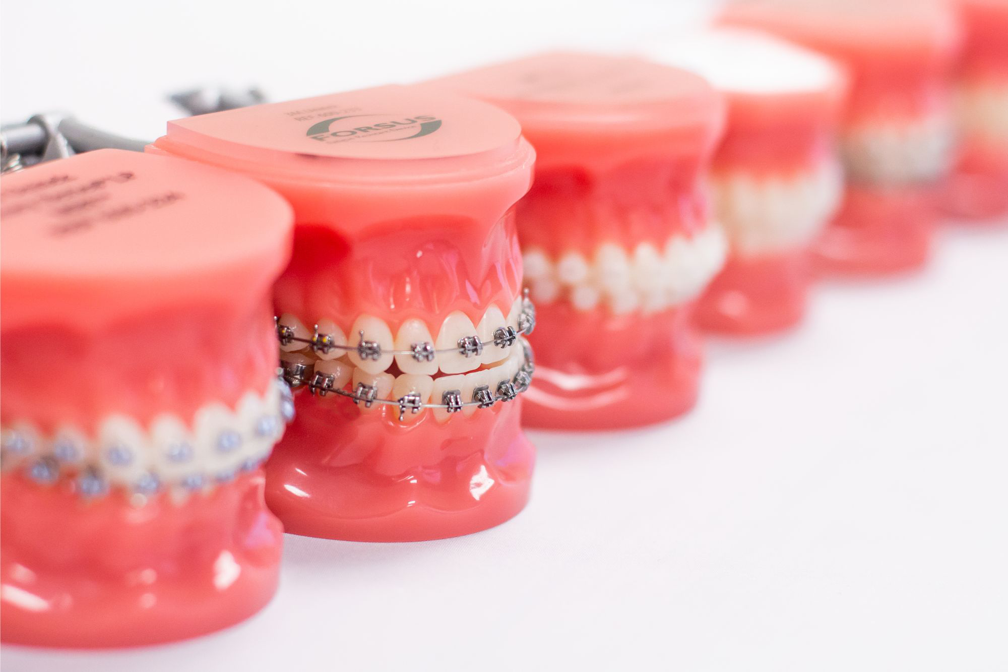 Why Orthodontic Rubber Bands Matter - Wiewiora & Dunn Orthodontics