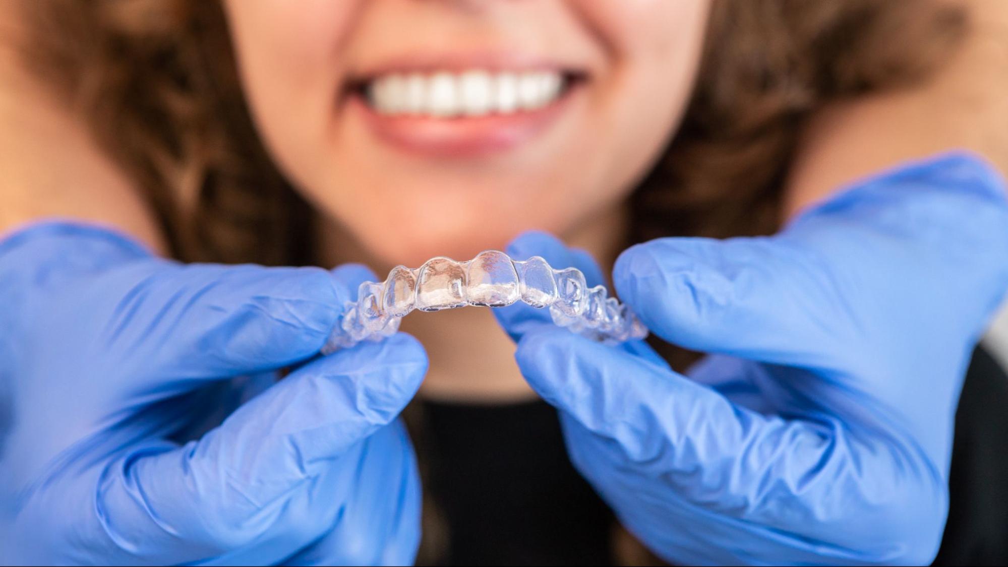 Are Clear Aligners Worth the Investment?