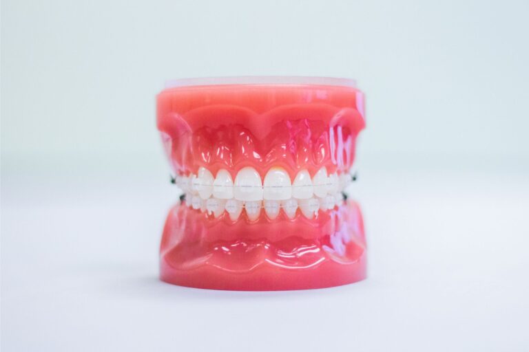 Clear braces option for orthodontics in Kansas City